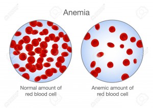 What is anemia, what it happens and how to get rid of it